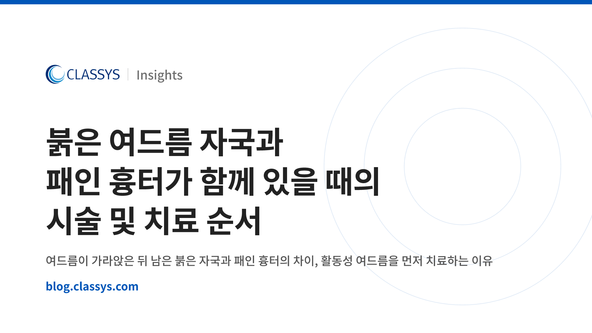 붉은 여드름 자국과 패인 흉터가 함께 있을 때의 시술 및 치료 순서