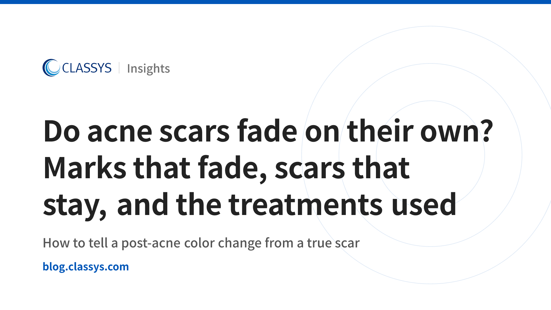 Do acne scars fade on their own? Marks that fade, scars that stay, and the treatments used