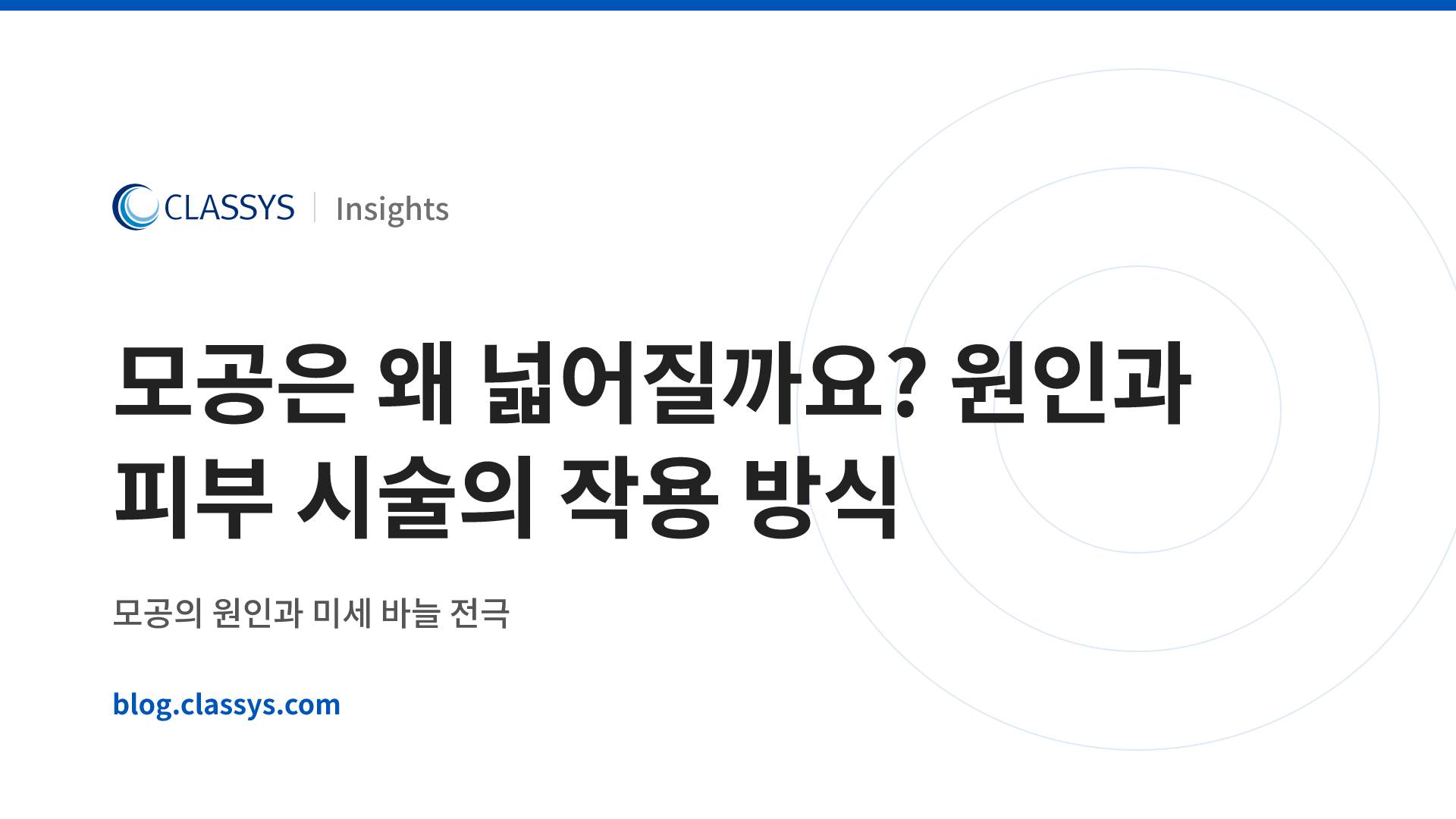모공은 왜 넓어질까요? 원인과 피부 시술의 작용 방식