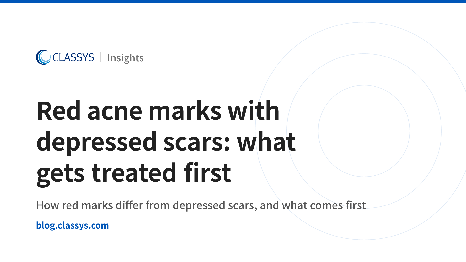 Red acne marks with depressed scars: what gets treated first