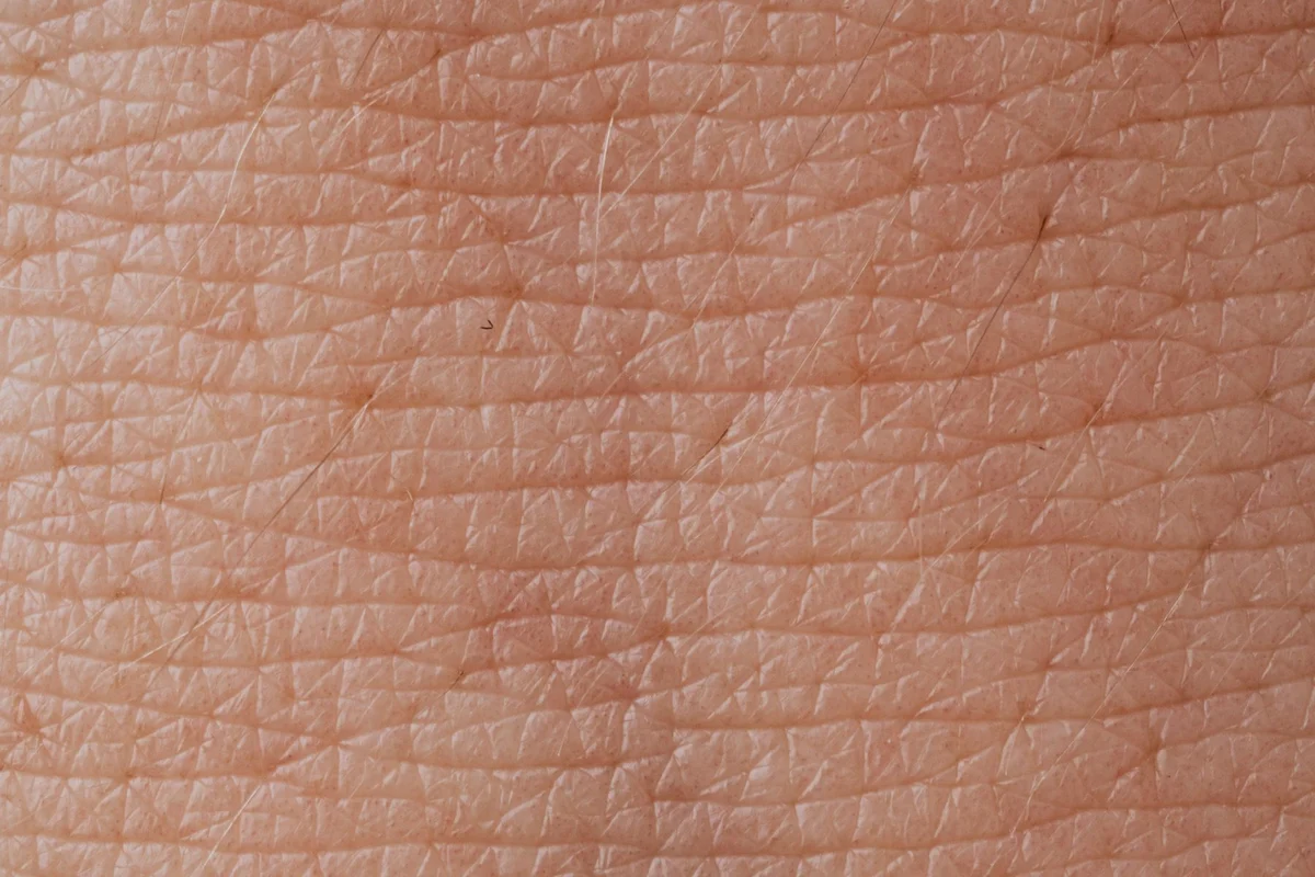 Close-up of skin texture. Illustrative stock photo, not a treatment result.