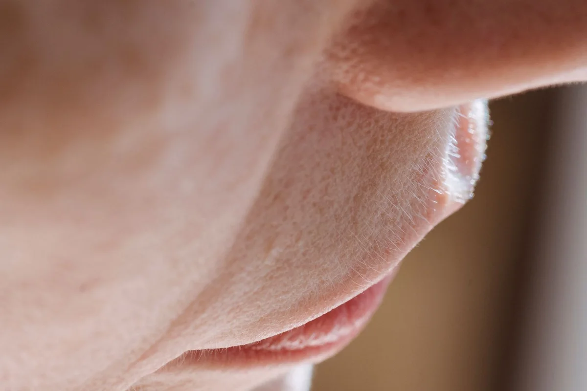 Close-up of natural skin texture around the lower face, not a treatment result
