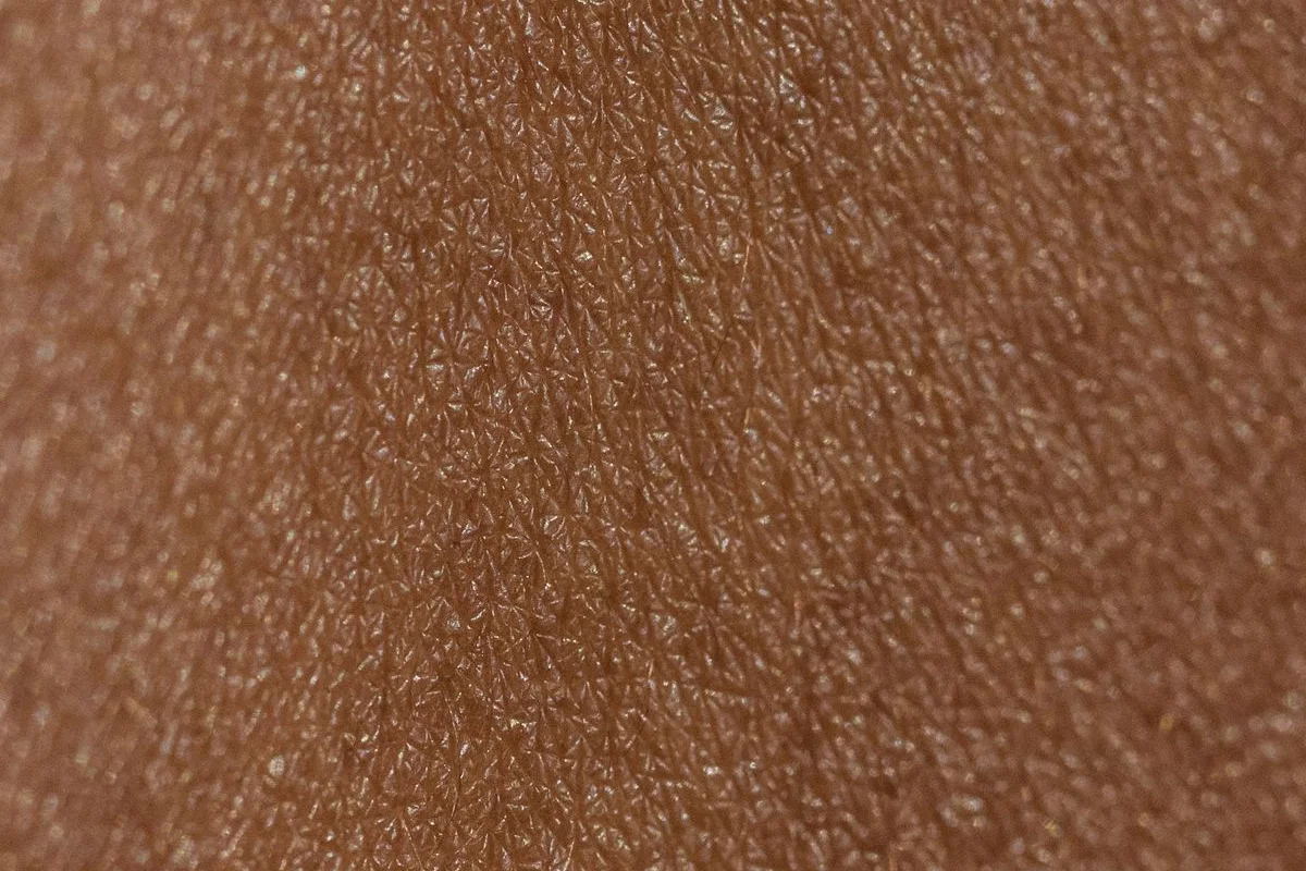 Macro view of natural skin texture, not an acne-scar or treatment-result photo
