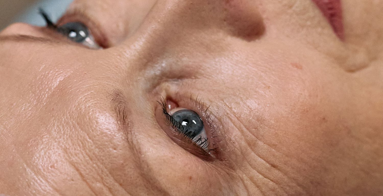 Close-up of the eye area: crow’s feet and under-eye fine lines on mature skin