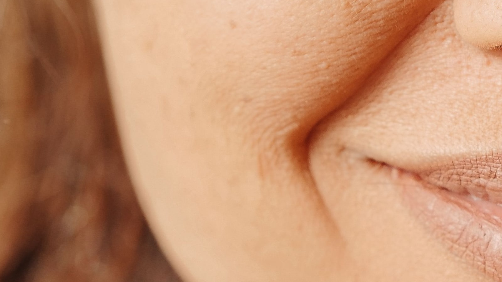 Close-up of a cheek and the crease that runs from beside the nose to the corner of the mouth